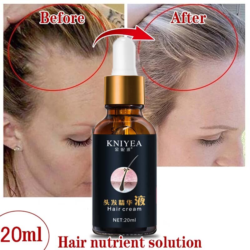 Hair Care Hair Growth Essential Oils Essence Original Authentic 100% Hair Loss Liquid Health Care Beauty Dense Hair Growth Serum