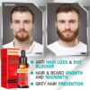 SAKSRAAR Hair Growth Essential Oils Essence 100% Original Anti Hair Loss Products Treatment Health Care Beauty Hair Growth Serum