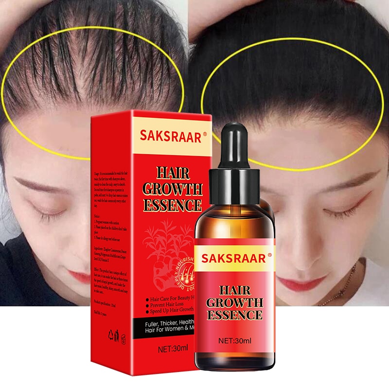 SAKSRAAR Hair Growth Essential Oils Essence 100% Original Anti Hair Loss Products Treatment Health Care Beauty Hair Growth Serum